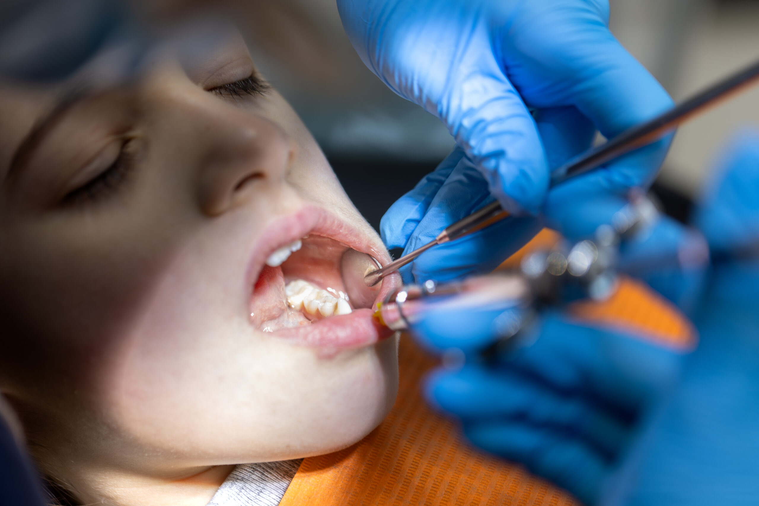 Girl in the dentist's office. Dentist examining child patient's teeth. High quality photo. Girl with open mouth at the dentist. Dentistry concept. Dental treatment at a specialist.