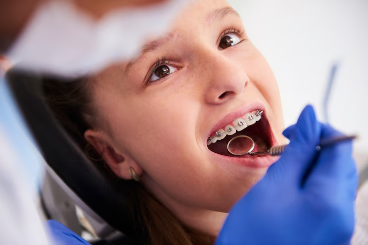 Understanding Gingivitis: Early Signs and How to Prevent It