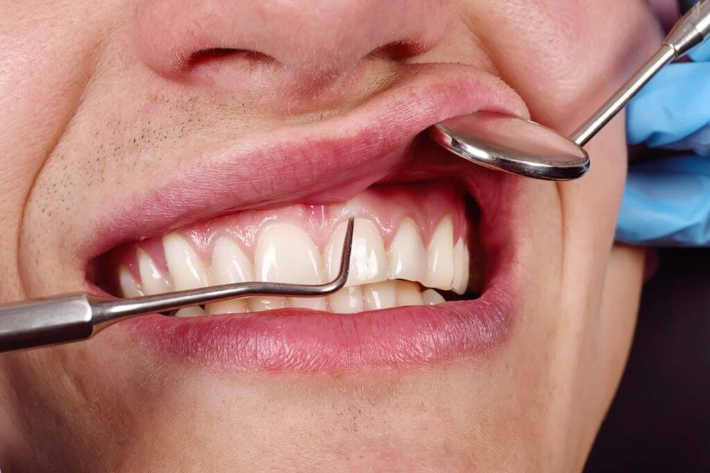 Recognizing Gum Disease Early: When to Seek Professional Treatment