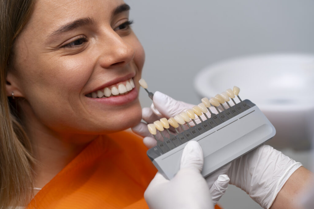 veneers in riverpark