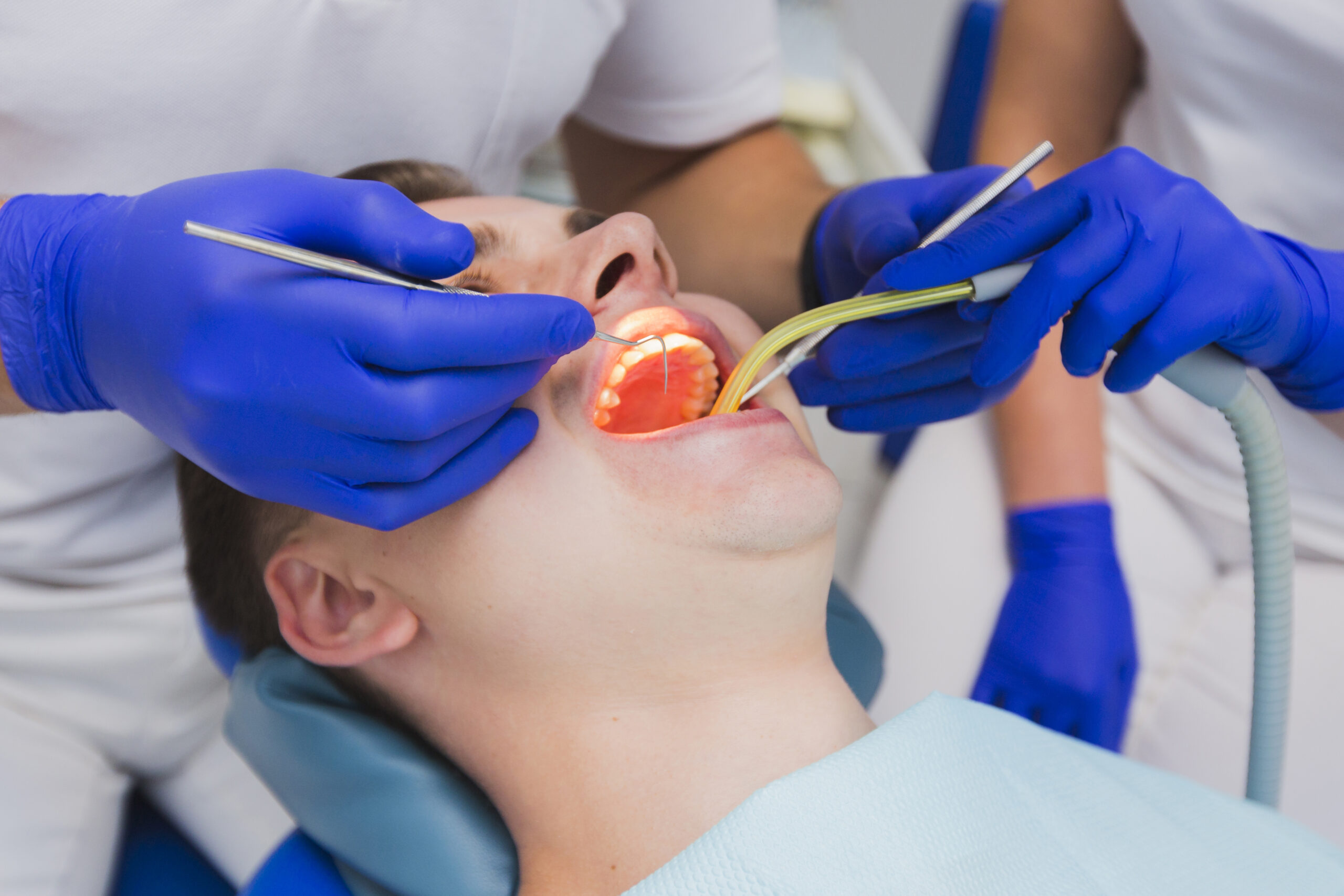 Dental Sealants for Adults in Riverpark: Are They Worth It?