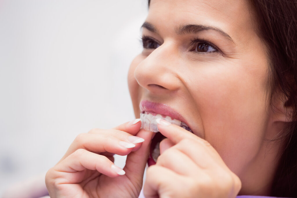 invisalign dentist in riverpark