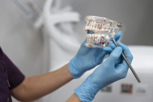 dental implants in Riverpark