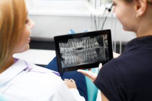 wisdom teeth 3D scans