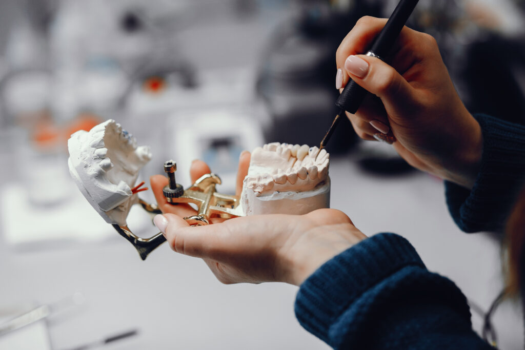 dental bridges