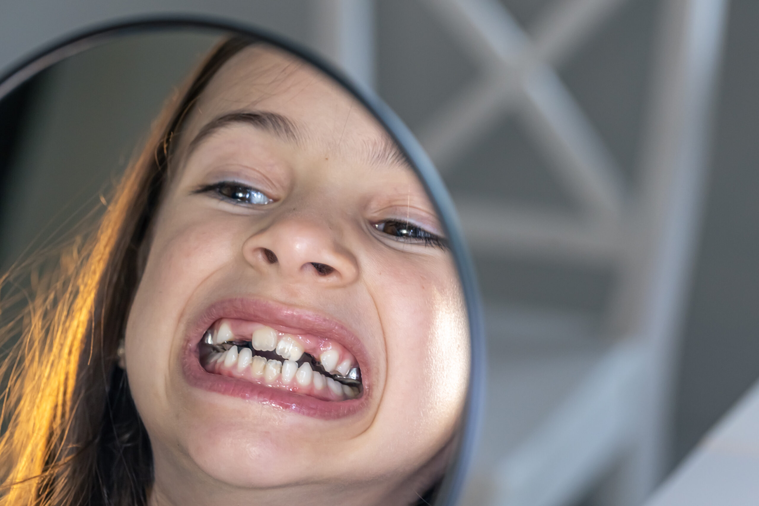 Dental Emergency