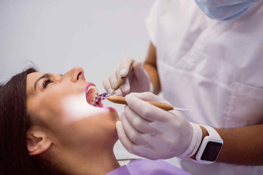 dental fillings in Riverpark