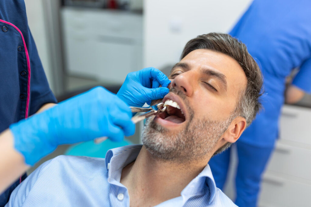 tooth extraction