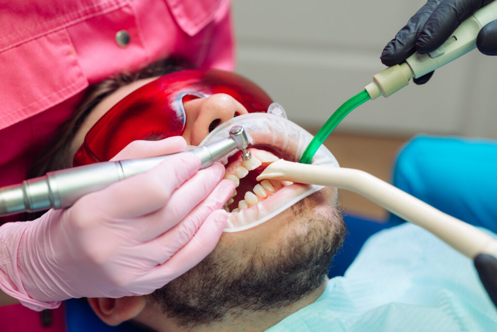 teeth cleaning in Riverpark