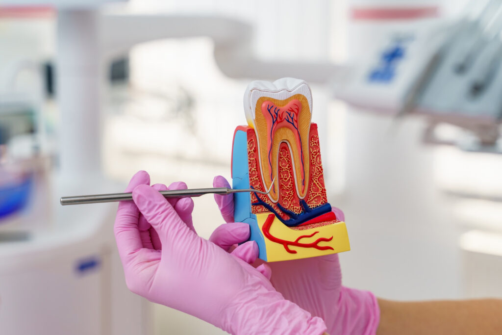 root canal treatments