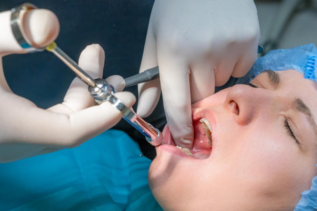 tooth extraction in Riverpark