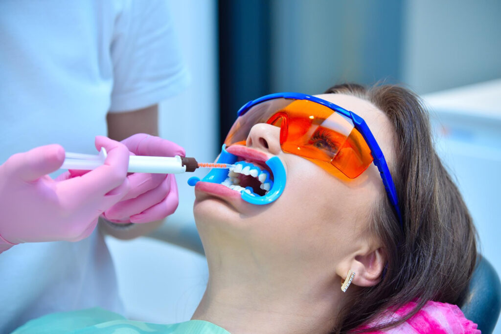 Fluoride treatment riverpark